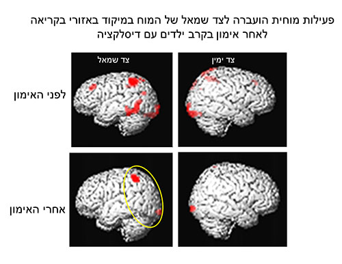 מוח